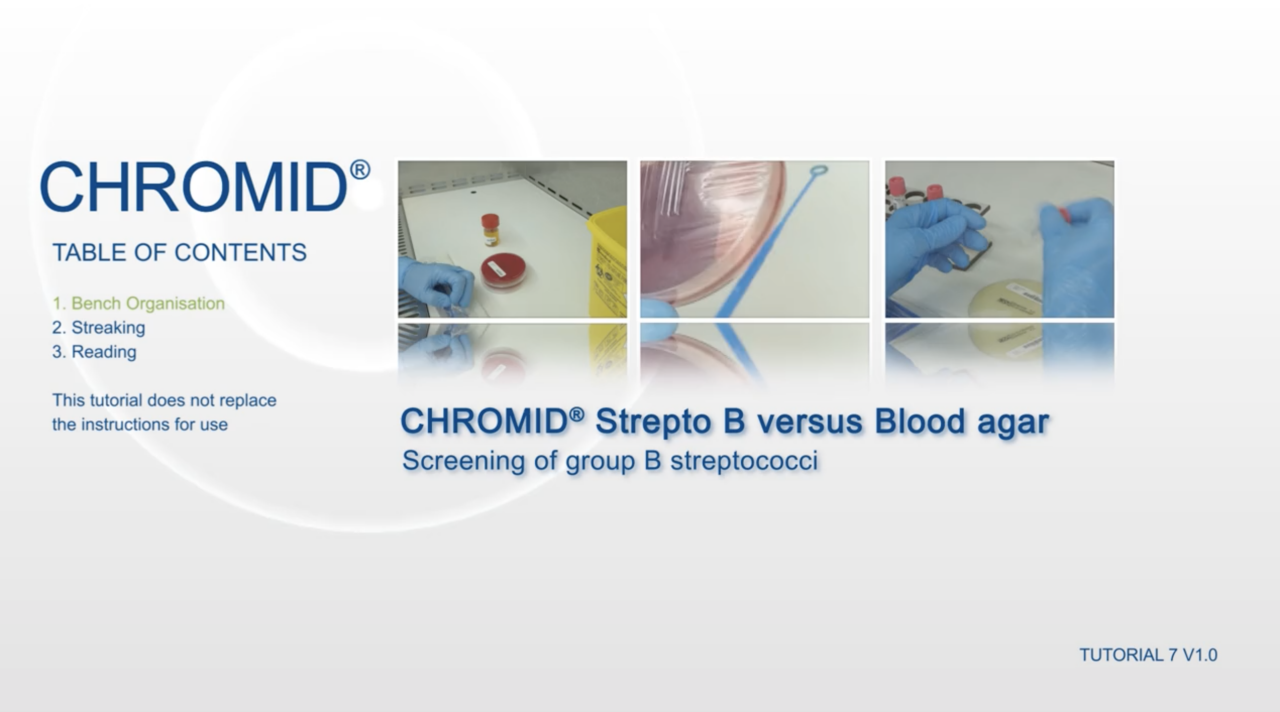 CHROMID® Strepto B Tutorial Video